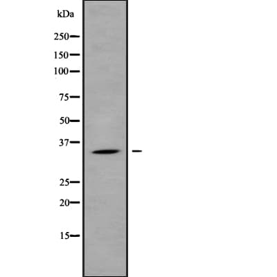 Polyclonal Rabbit anti-Human OR1L8 Antibody (WB)
