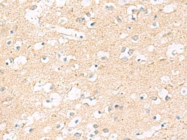 MRPL20 Antibody