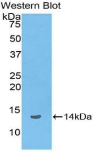 Beta Lipotropin Antibody (aa179-267, FITC)
