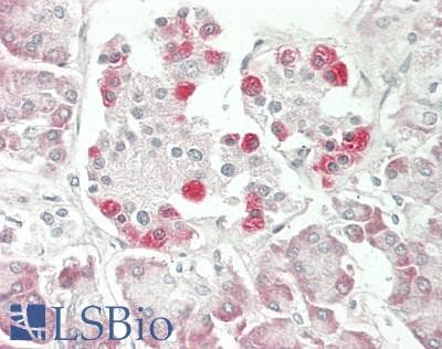 PathPlus™ Monoclonal Rat anti-Human BCL2L2 / Bcl-w Antibody (IHC, WB)