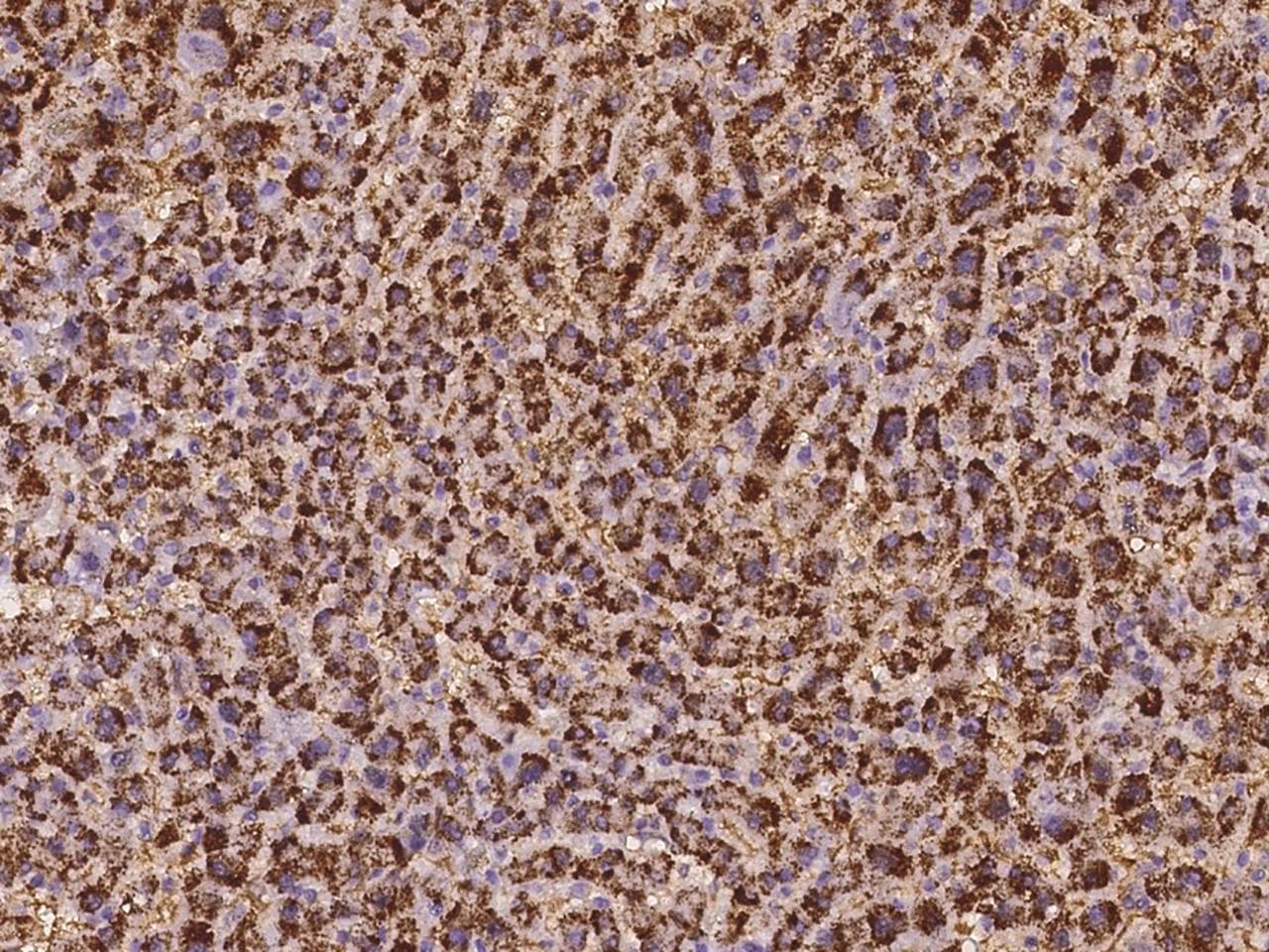 Polyclonal Rabbit anti-Human EXOC6 / SEC15 Antibody (IHC)