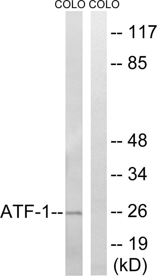 ATF1 Antibody (p63)