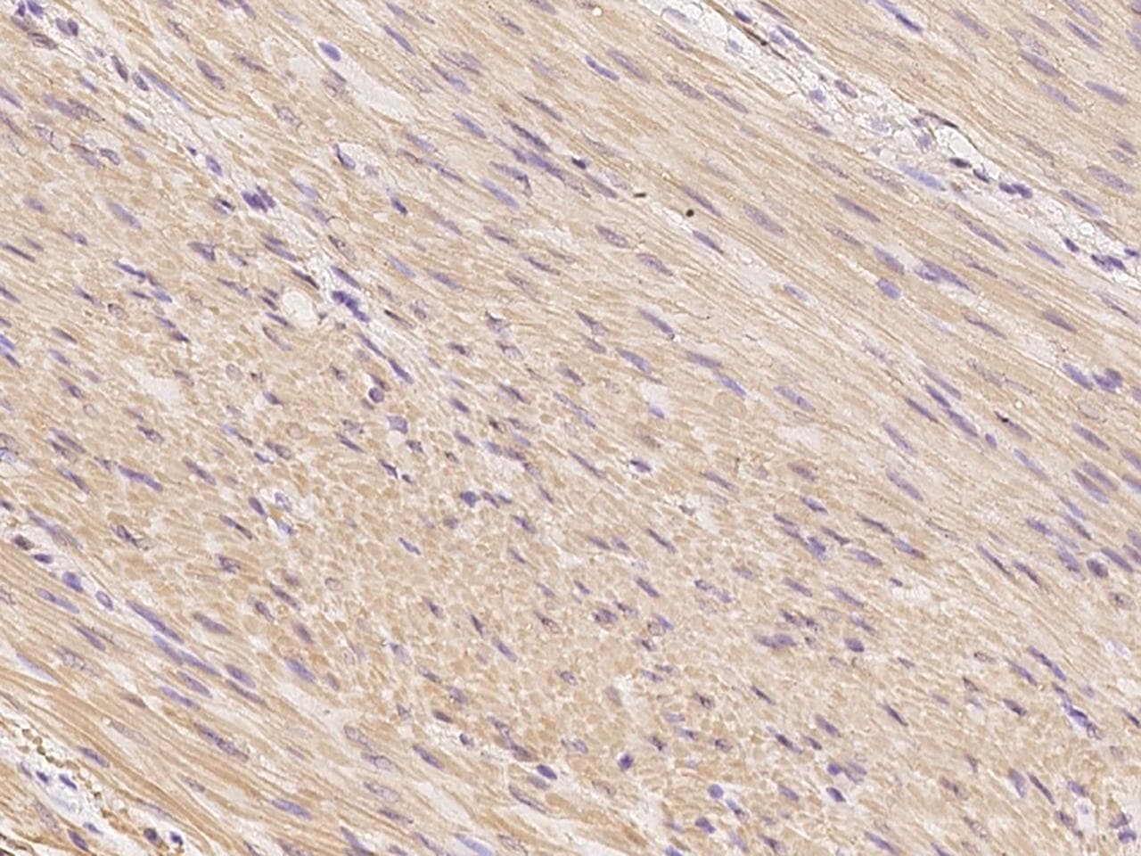 Smoothelin Antibody