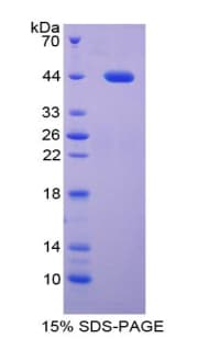 Mouse Procalcitonin Protein (Recombinant His-GST)