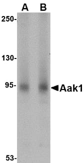 IHC-plus™ AAK1 Antibody