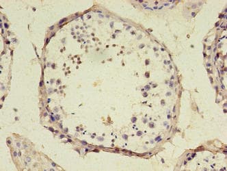SRSF10 / FUSIP1 Antibody (aa1-183)