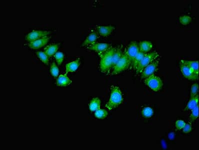 MAP3K8 / TPL2 Antibody