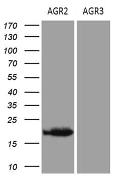 Monoclonal Mouse anti-Human AGR2 Antibody (clone OTI2B10, aa21-175, IHC, WB)