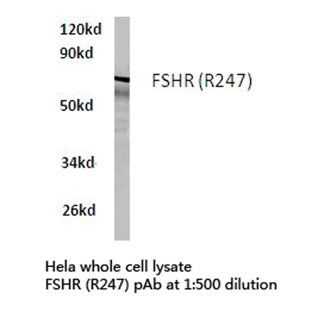 FSH Receptor / FSHR Antibody (Arg247)