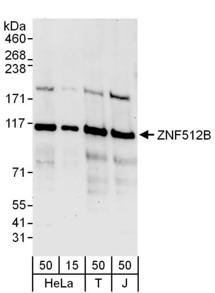 ZNF512B Antibody (aa842-892)