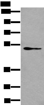 GATA3 Antibody