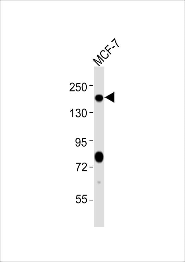 Polyclonal Rabbit anti-Human PTCH1 / Patched 1 Antibody (WB)