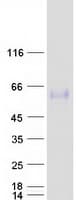 Human OSTM1 Protein (Recombinant Myc-DDK (Flag))