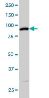 IHC-plus™ SRPK1 Antibody (clone 6H5)