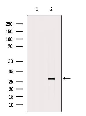 MMAB Antibody