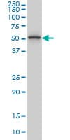 ZRP-1 / TRIP6 Antibody (clone 4B7)