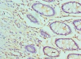 AP50 / AP2M1 Antibody (aa136-435)