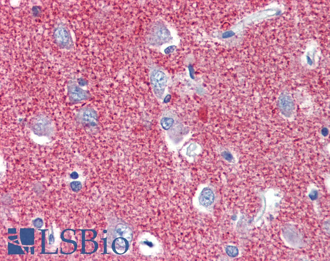 SLC25A28 Antibody (aa290-339)