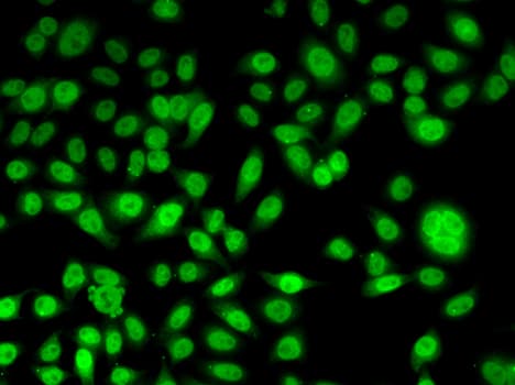 PPL / Periplakin Antibody