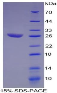 Human ATF1 Protein (Recombinant His-T7)