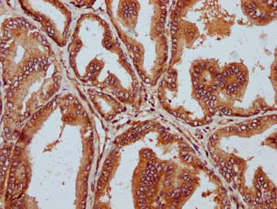 Polyclonal Rabbit anti-Human STT3B Antibody (IHC)