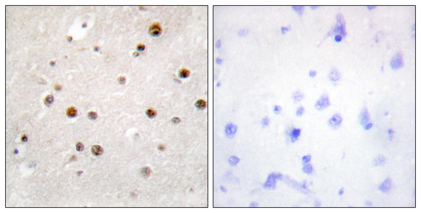 TSN / Translin Antibody