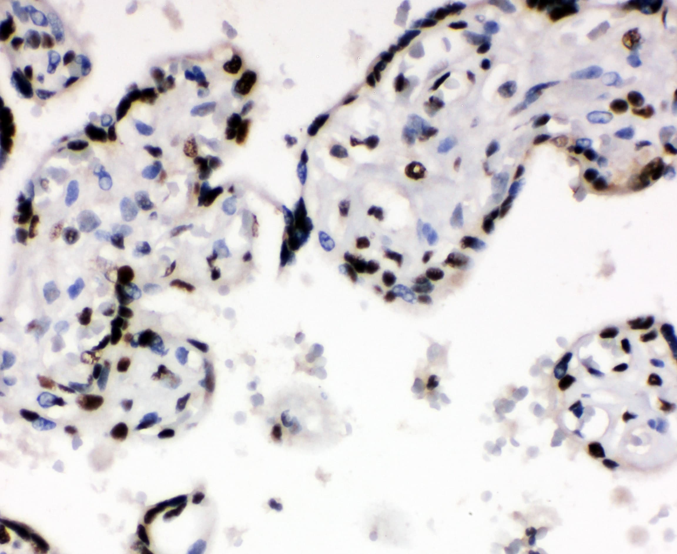 XRCC6 / Ku70 Antibody (aa530-545)