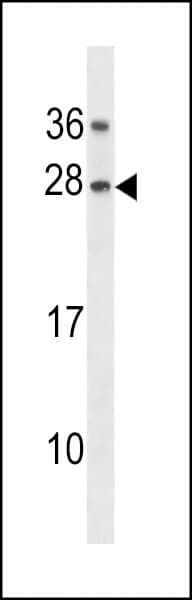 GAR1 / NOLA1 Antibody (aa86-114)
