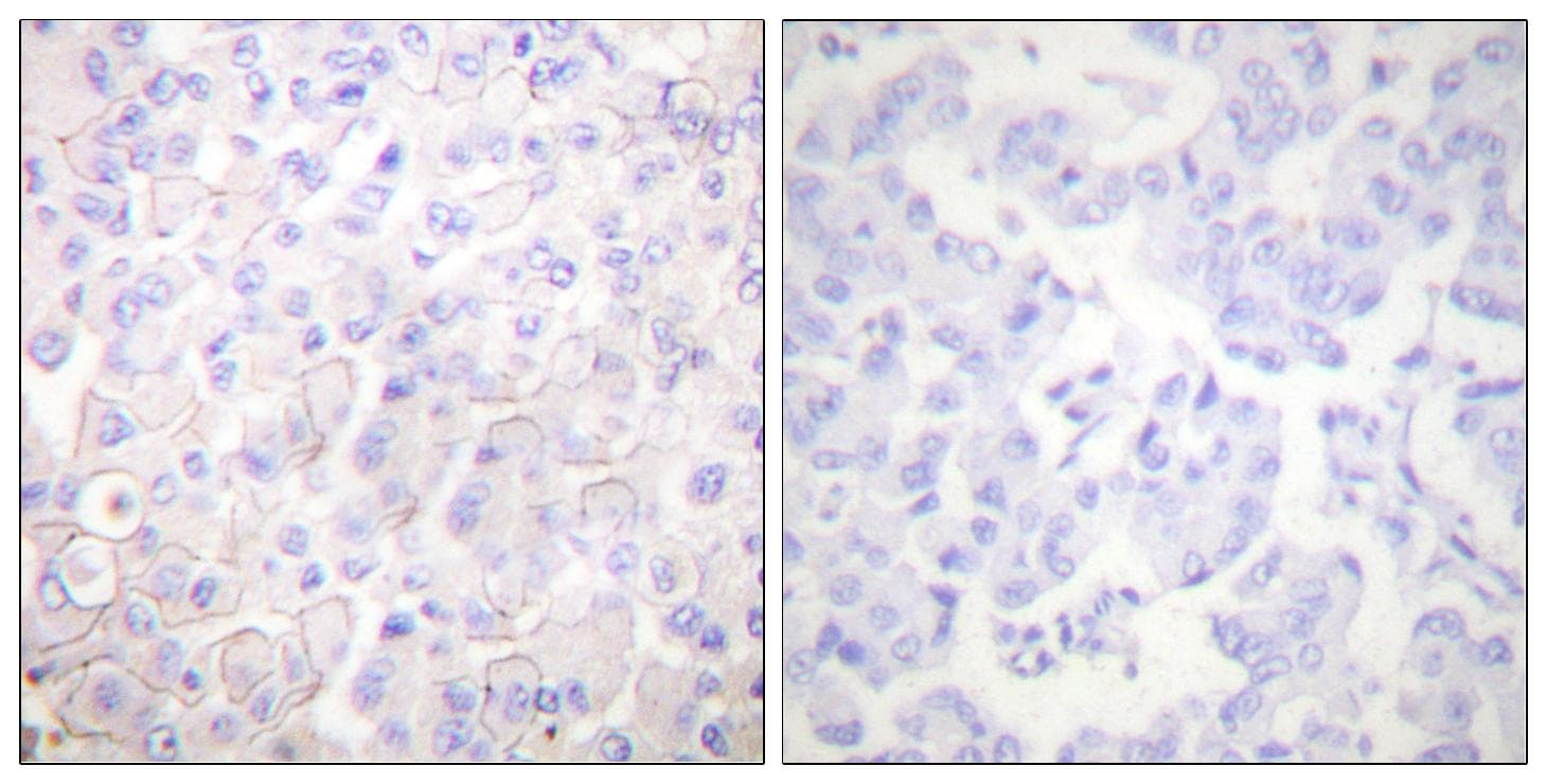 CDH1 / E Cadherin Antibody