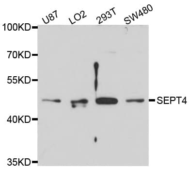 SEPT4 / Septin 4 Antibody
