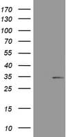 ABCB1 / MDR1 / P Glycoprotein Antibody (clone OTI2H10)