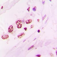 EAR2 / NR2F6 Antibody (N-Terminus)