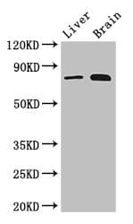 NAK / TBK1 Antibody