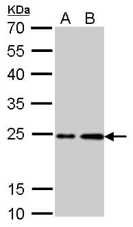 IHC-plus™ Polyclonal Rabbit anti-Human HRAS / H-Ras Antibody (aa111-189, IHC, WB)