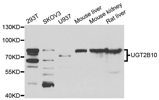 Polyclonal Rabbit anti-Human UGT2B10 Antibody (IHC, WB)
