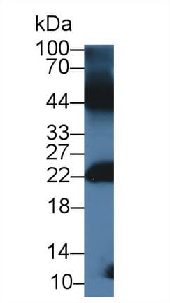 GREM1 / Gremlin-1 Antibody (aa27-184, APC)