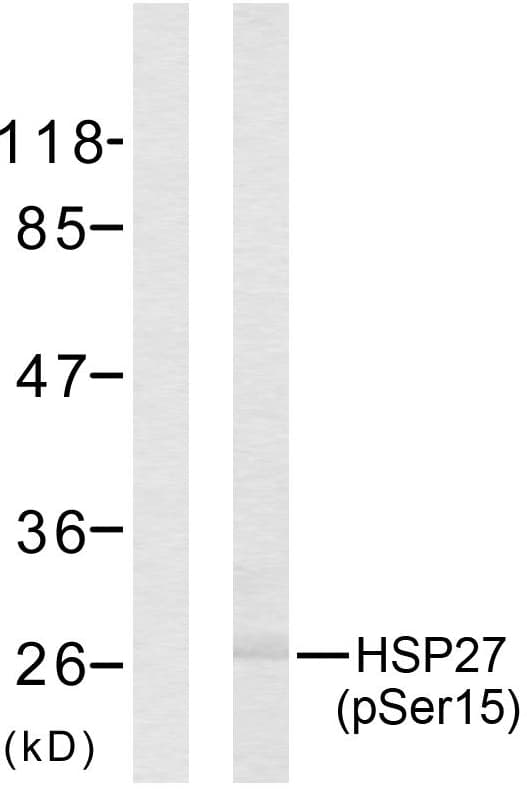Polyclonal Rabbit anti-Human HSPB1 / HSP27 Antibody (phospho-Ser15, IHC, WB)