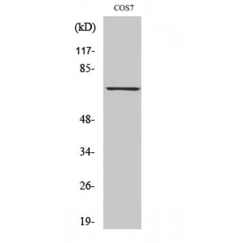 Polyclonal Rabbit anti-Human SYK Antibody (460-540 aa, IHC, WB)