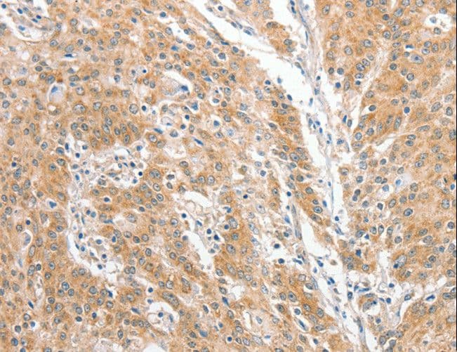 COL4A3BP / CERT Antibody