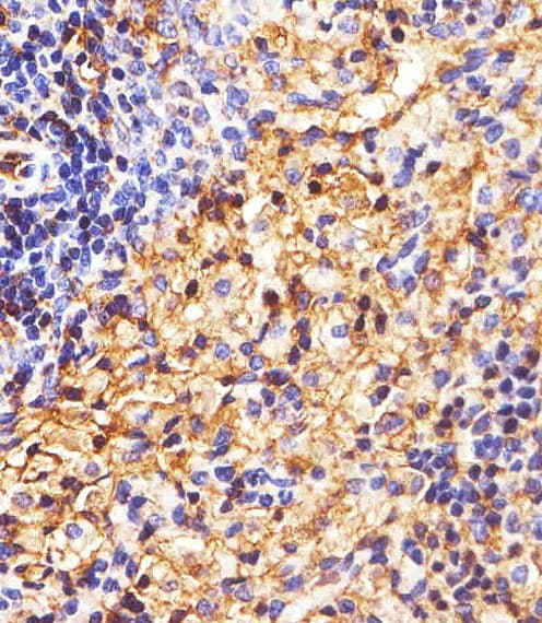 HLA-B Antibody (N-Terminus)