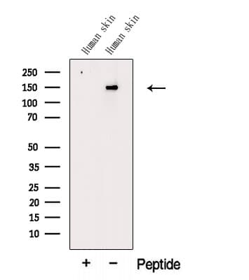Polyclonal Rabbit anti-Human COL5A2 / Collagen V Alpha 2 Antibody (WB)