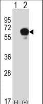 Polyclonal Rabbit anti-Human DPYSL3 / CRMP4 Antibody (aa461-490, IHC, WB)