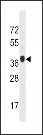 MNX1 / HB9 Antibody (aa242-271)