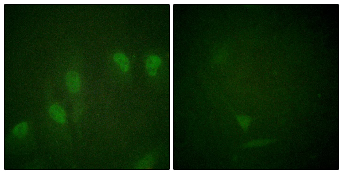 MYC / c-Myc Antibody (phospho-Ser62)