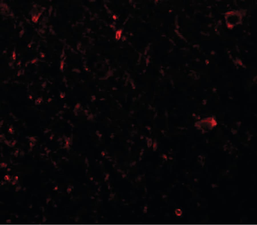 IHC-plus™ PLEKHM3 Antibody