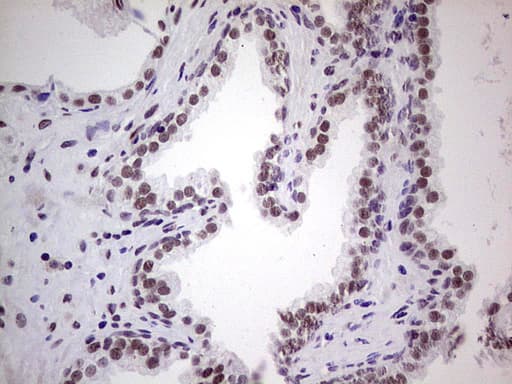 Monoclonal Mouse anti-Human ERCC1 Antibody (clone OTI2H1, IHC, WB)