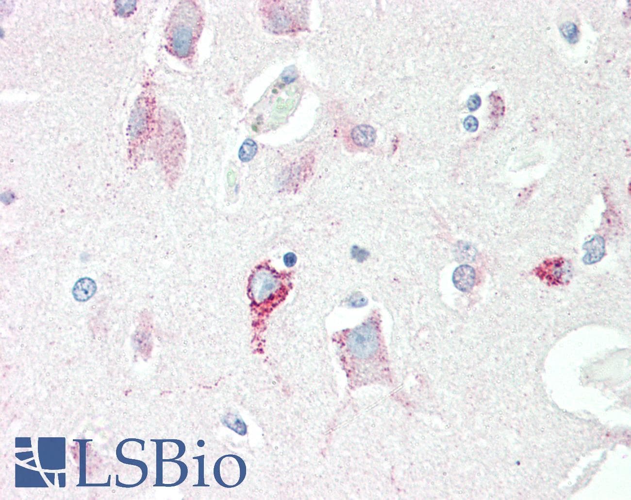 IHC-plus™ SRR / Serine Racemase Antibody (clone 9E8)