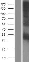 CRISP2 / TSP1 Protein (Over-Expression Lysate Myc-DDK (Flag))