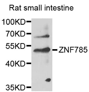 Polyclonal Rabbit anti-Human ZNF785 Antibody (IHC, WB)