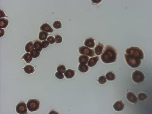 p16INK4a / CDKN2A Antibody (clone OTI2G1)